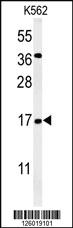 Anti-NAA50 Rabbit Polyclonal Antibody