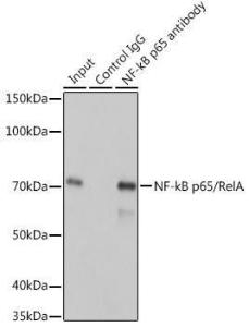 Anti-NF-kB p65 Rabbit Monoclonal Antibody [clone: ARC51086]