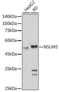 Western blot analysis of extracts of various cell lines, using Anti-NSUN5 Antibody (A11908) at 1:1,000 dilution. The secondary antibody was Goat Anti-Rabbit IgG H&L Antibody (HRP) at 1:10,000 dilution.