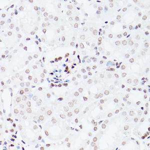 Immunohistochemistry analysis of paraffin-embedded mouse kidney using Anti-NSUN5 Antibody (A11908)Immunohistochemistry analysis of paraffin-embedded Mouse kidney using NSUN5 antibody ( A5992) at a dilution of 1:100 (40x lens)