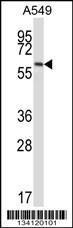 Anti-FZD5 Rabbit Polyclonal Antibody (APC (Allophycocyanin))