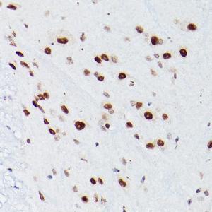 Immunohistochemistry analysis of paraffin-embedded mouse spinal cord using Anti-NSUN5 Antibody (A11908)Immunohistochemistry analysis of paraffin-embedded Mouse spinal cord using NSUN5 antibody ( A5992) at a dilution of 1:100 (40x lens)