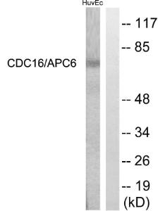 Western blot analysis of lysates from HUVEC cells using Anti-CDC16 Antibody. The right hand lane represents a negative control, where the antibody is blocked by the immunising peptide.