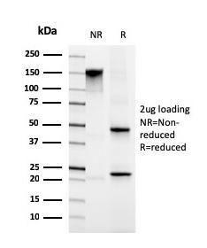 SDS-PAGE analysis of Anti-Migfilin Antibody [FBLIM1/4600] under non-reduced and reduced conditions; showing intact IgG and intact heavy and light chains, respectively. SDS-PAGE analysis confirms the integrity and purity of the Antibody