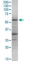 Anti-LDHD Rabbit Polyclonal Antibody