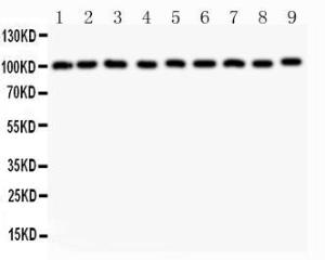 Anti-CBL/C Cbl Polyclonal Antibody