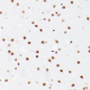 Immunohistochemistry analysis of paraffin-embedded rat brain using Anti-NSUN5 Antibody (A11908)Immunohistochemistry analysis of paraffin-embedded Rat brain using NSUN5 antibody ( A5992) at a dilution of 1:100 (40x lens)