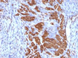 Immunohistochemical analysis of formalin-fixed, paraffin-embedded rat uterus using Anti-Calponin 1 Antibody [CNN1/832 + CALP]