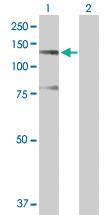 Anti-SUGP2 Rabbit Polyclonal Antibody