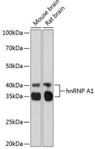 Western blot analysis of extracts of various cell lines, using Anti-hnRNP A1 Antibody [ARC0633] (A305568) at 1:1,000 dilution. The secondary antibody was Goat Anti-Rabbit IgG H&L Antibody (HRP) at 1:10,000 dilution.