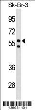 Anti-FBXO31 Rabbit Polyclonal Antibody