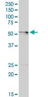 Anti-LDHD Rabbit Polyclonal Antibody