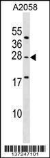 Anti-EPDR1 Rabbit Polyclonal Antibody (APC (Allophycocyanin))