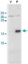 Anti-PTGES Rabbit Polyclonal Antibody