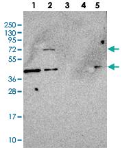 Anti-MOCS1 Rabbit Polyclonal Antibody