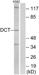 Western blot analysis of lysates from K562 cells using Anti-DCT Antibody. The right hand lane represents a negative control, where the antibody is blocked by the immunising peptide