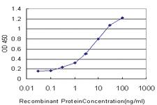 Anti-SLC26A4 Mouse Monoclonal Antibody [clone: 3D2]