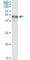 Anti-B4GALT3 Polyclonal Antibody Pair