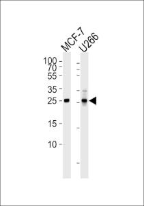 Anti-CDKN1B Mouse Monoclonal Antibody [clone: 1373CT407.103.103]