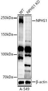 Western blot analysis of extracts from wild type(WT) and NPHS1 knockdown (KD) A-549 cells, using Anti-Nephrin Antibody (A306577) at 1:800 dilution