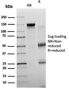 SDS-PAGE analysis of Anti-NeuroG3 Antibody [PCRP-NEUROG3-1E10] under non-reduced and reduced conditions; showing intact IgG and intact heavy and light chains, respectively. SDS-PAGE analysis confirms the integrity and purity of the antibody.