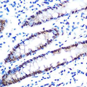 Immunohistochemistry analysis of paraffin-embedded human colon tissue using Anti-hnRNP A1 Antibody [ARC0633] (A305568) at a dilution of 1:100 (40x lens). Perform microwave antigen retrieval with 10 mM PBS buffer pH 7.2 before commencing with IHC staining protocol.