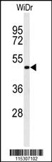 Anti-GATA6 Rabbit Polyclonal Antibody