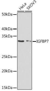 Western blot analysis of extracts of various cell lines, using Anti-IGFBP7 Antibody [ARC1052] (A306578) at 1:1,000 dilution