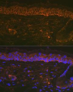 Immunofluorescence analysis of mouse tail and ear using Anti-Cytokeratin 16/K16 Antibody [ARC1783] (A307945) at a dilution of 1:100 (40X lens). DAPI was used to stain the cell nuclei (blue)