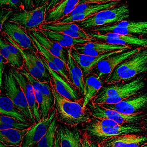 Immunofluorescent analysis of HeLa cells stained with Anti-MARCKS Antibody (1:1,000/red) and Anti-Beta Tubulin Antibody (A85428/1:10,000/green)