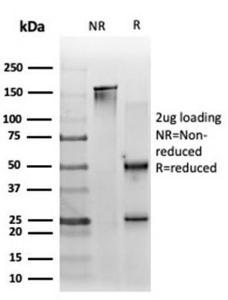 SDS-PAGE analysis of Anti-ZNF562 Antibody [PCRP-ZNF562-1A1] under non-reduced and reduced conditions; showing intact IgG and intact heavy and light chains, respectively. SDS-PAGE analysis confirms the integrity and purity of the antibody.