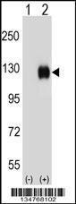 Anti-EPHB4 Rabbit Polyclonal Antibody (PE (Phycoerythrin))