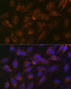 Immunofluorescence analysis of U-251 MG cells using Anti-IGFBP7 Antibody [ARC1052] (A306578) at a dilution of 1:100 (40X lens). DAPI was used to stain the cell nuclei (blue)