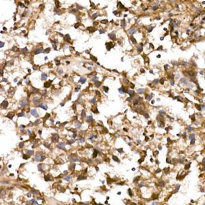 Immunohistochemistry analysis of paraffin-embedded human testicular seminoma using Anti-Lin28A Antibody (A11914) at a dilution of 1:200 (40x lens). Perform high pressure antigen retrieval with 10 mM Tris/EDTA buffer pH 9.0 before commencing with IHC staining protocol.