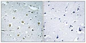 Anti-TRIP15 Rabbit Polyclonal Antibody