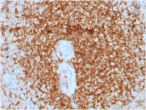 Immunohistochemical analysis of formalin-fixed, paraffin-embedded human spleen using Anti-Bcl-2 Antibody [rBCL2/796]