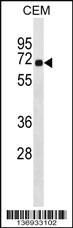 Anti-CEP57 Rabbit Polyclonal Antibody