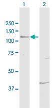 Anti-FUK Rabbit Polyclonal Antibody