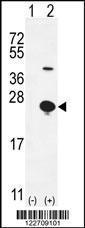 Anti-EPGN Rabbit Polyclonal Antibody (AP (Alkaline Phosphatase))