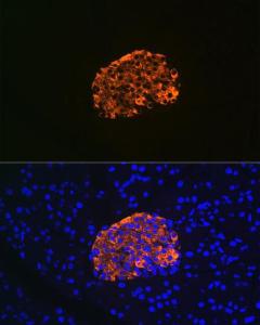 Immunofluorescence analysis of rat pancreas using Anti-IGFBP7 Antibody [ARC1052] (A306578) at a dilution of 1:100 (40X lens). DAPI was used to stain the cell nuclei (blue)