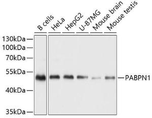 Western blot analysis of extracts of various cell lines, using Anti-polyclonal antibodyPN1 Antibody (A11915) at 1:1,000 dilution The secondary antibody was Goat Anti-Rabbit IgG H&L Antibody (HRP) at 1:10,000 dilution Lysates/proteins were present at 25 µg per lane