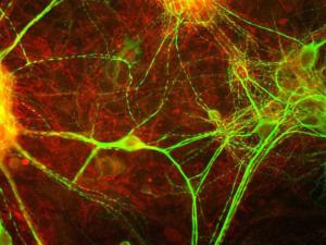 View of mixed neuron/glial cultures stained with Anti-MARCKS Antibody (red) and Anti-MAP2 Antibody (A85363/green). Note that the Anti-MARCKS Antibody stains vesicular structures both in the glial cells and in the dendrites of the neurons, which are strongly stained with the Anti-MAP2 Antibody