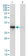 Anti-PDYN Mouse Monoclonal Antibody [clone: 2E12]