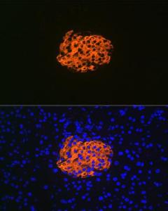 Immunofluorescence analysis of mouse pancreas using Anti-IGFBP7 Antibody [ARC1052] (A306578) at a dilution of 1:100 (40X lens). DAPI was used to stain the cell nuclei (blue)