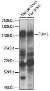 Western blot analysis of extracts of various cell lines, using Anti-PUM1 Antibody (A6108) at 1:1,000 dilutio