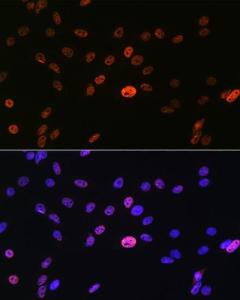 Immunofluorescence analysis of C6 cells using Anti-hnRNP A1 Antibody [ARC0633] (A305568) at a dilution of 1:100 (40x lens). DAPI was used to stain the cell nuclei (blue).