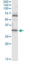 Anti-PDYN Mouse Monoclonal Antibody [clone: 2E12]