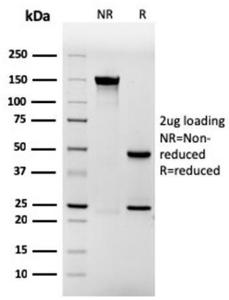 Anti-Involucrin Mouse Recombinant Antibody [clone: rIVRN/827]