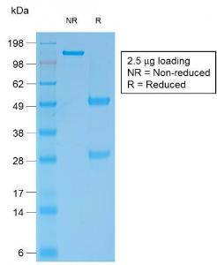 SDS-PAGE analysis of Anti-Bcl-2 Antibody [rBCL2/796] under non-reduced and reduced conditions; showing intact IgG and intact heavy and light chains, respectively. SDS-PAGE analysis confirms the integrity and purity of the antibody