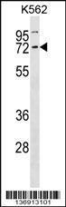 Anti-CCNK Rabbit Polyclonal Antibody (Biotin)